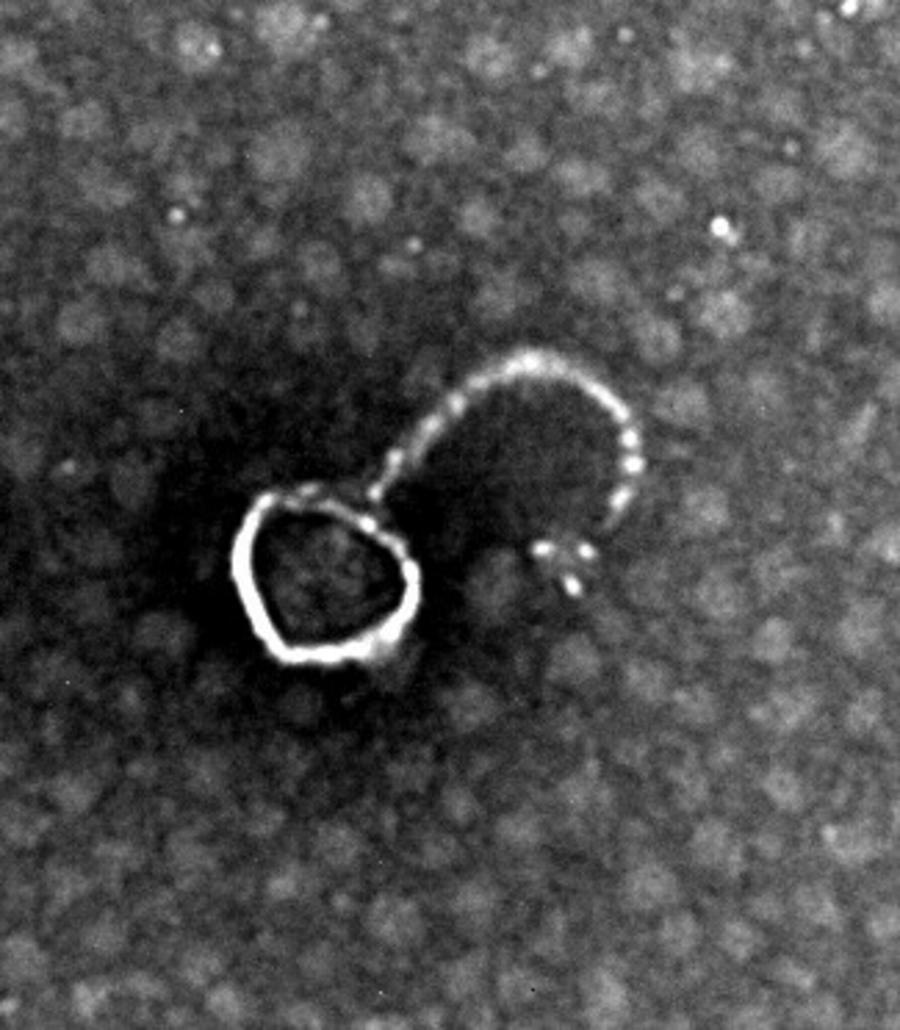 Elektronenmikroskopische Aufnahmen Bakteriophage 2