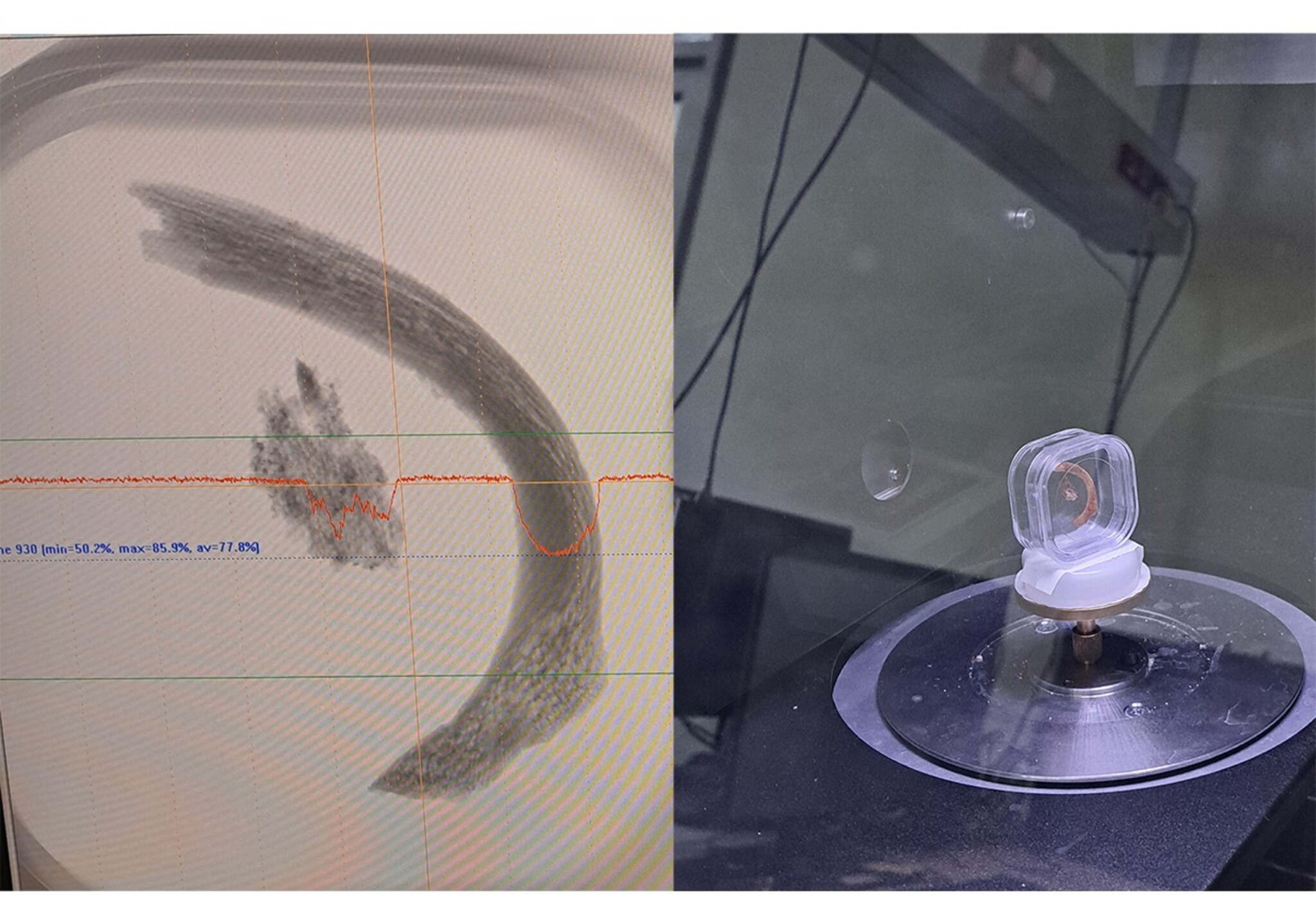 Knochen im Scanner und Darstellung am Bildschirm